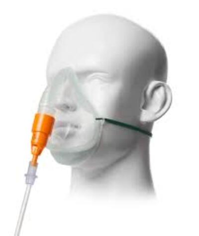 Intersurgical Venturi 28% Oxygen Mask