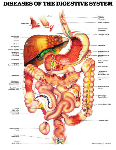 Poster - Diseases of the Digestive System