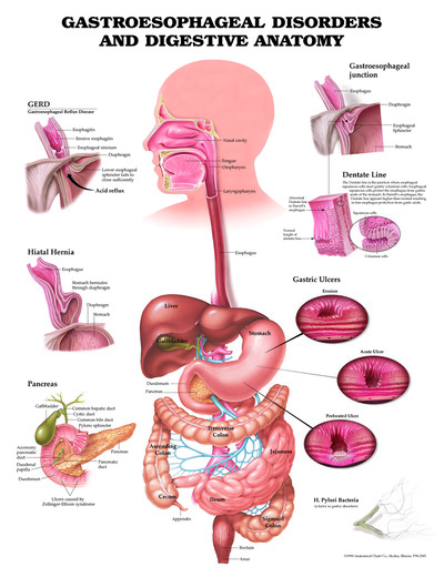 Poster - Gastroesophageal Disorders and Digestive Anatomy