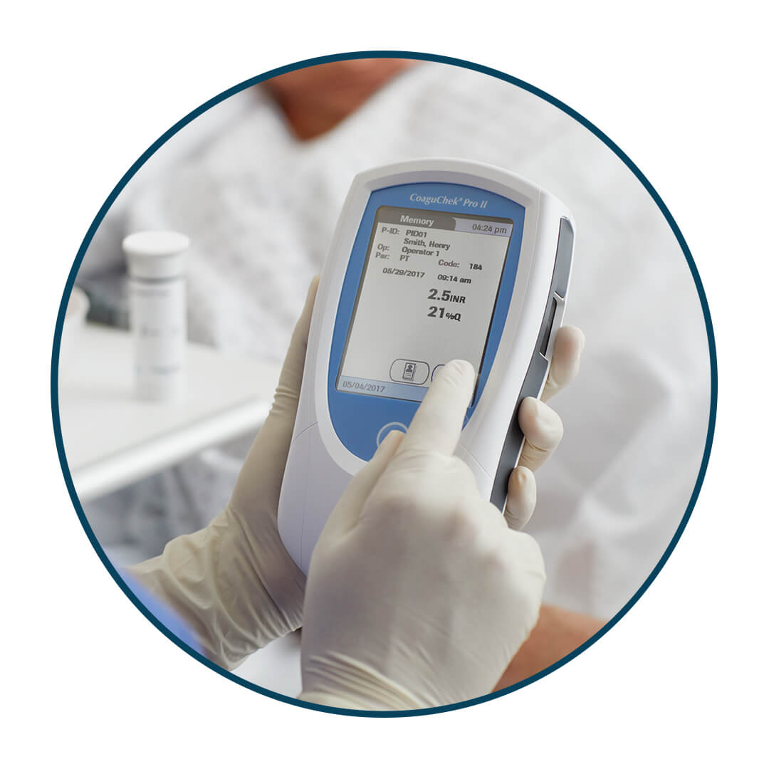Roche Rpp Machine Roche CoaguChek® Point of Care Testing and INR Machines | Health Care ...